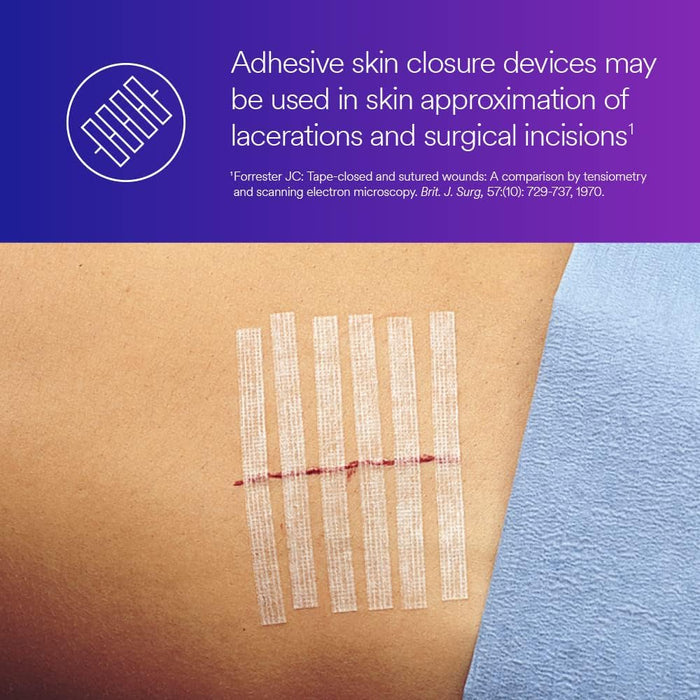 3M Steri-Strip Adhesive Skin Closures - Case of 200 Packs